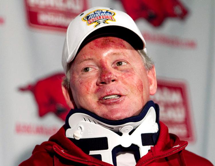 Flashback: A Breakdown of Bobby Petrino’s Motorcycle Crash and Accompanying Lies